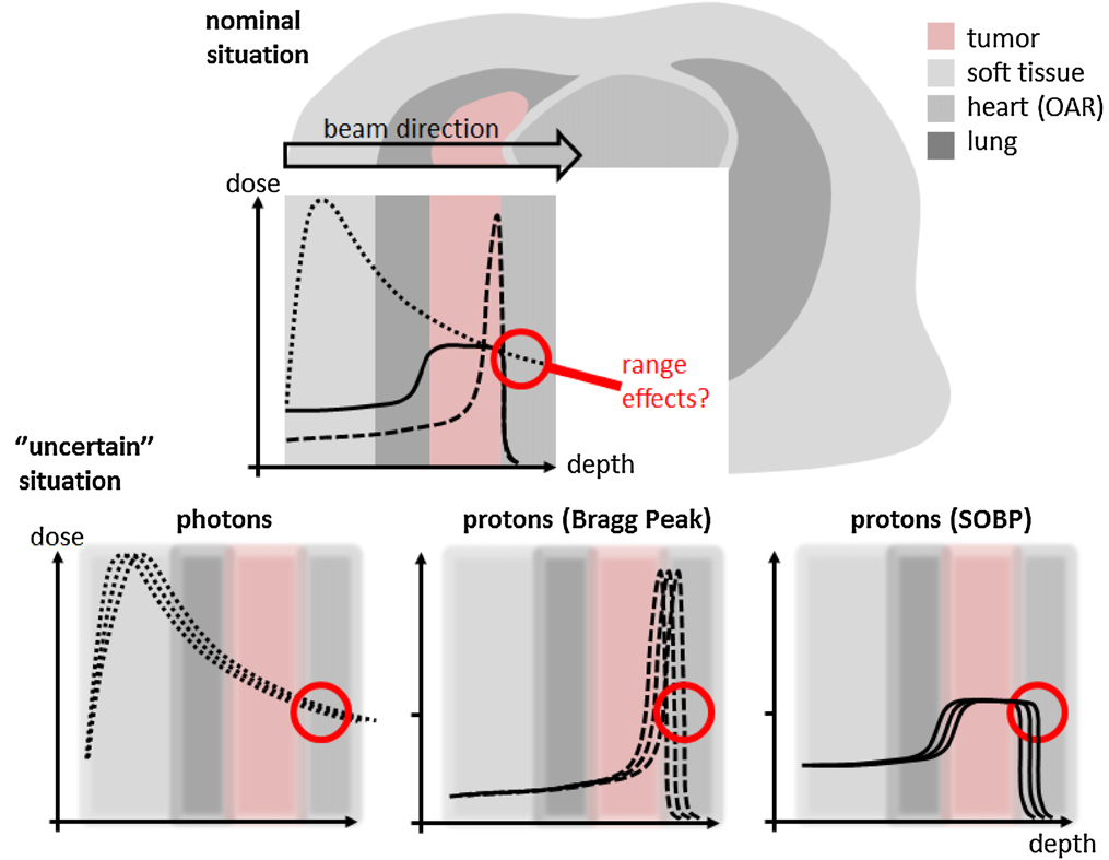 Proton Beam Therapy